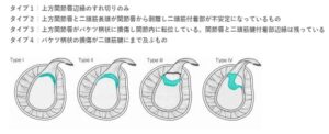 投球障害肩 Slap損傷 肩関節外科 牧整形外科病院 大阪市城東区 脊椎 人工関節 スポーツ整形 ペインクリニック 牧ヘルスケアグループ 医療法人 清翠会